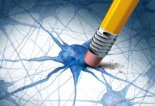 Alzheimers Dementia Brain Disease Concept