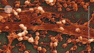 كيف تضر الشيخوخة باستجابة الجسم للعدوى الهائجة