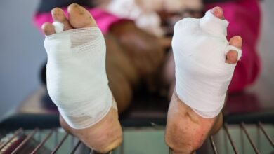 ما يكمن في جروح القدم السكرية قد يفسر فشل العلاج