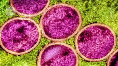 هل سيصبح mpox عالميًا مرة أخرى؟ تظهر الأبحاث أنها تتطور بطرق غريبة