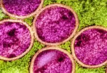 هل سيصبح mpox عالميًا مرة أخرى؟ تظهر الأبحاث أنها تتطور بطرق غريبة